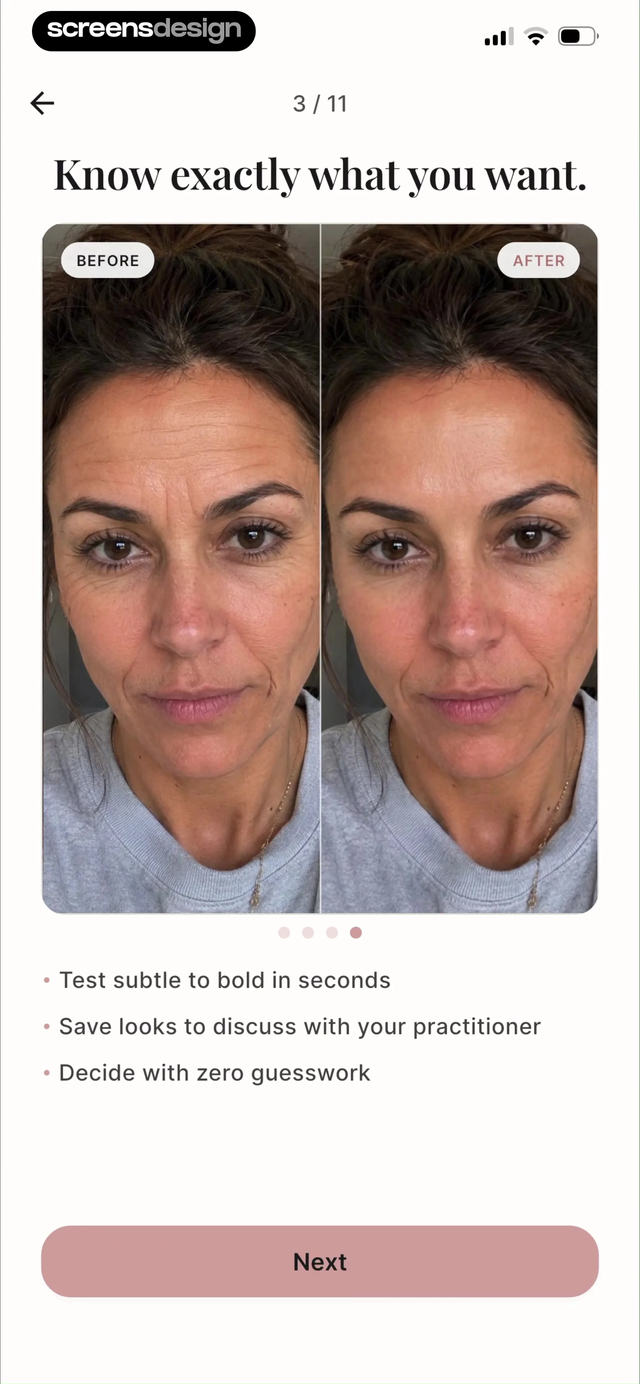 Refina: AI Plastic Surgery screen 8