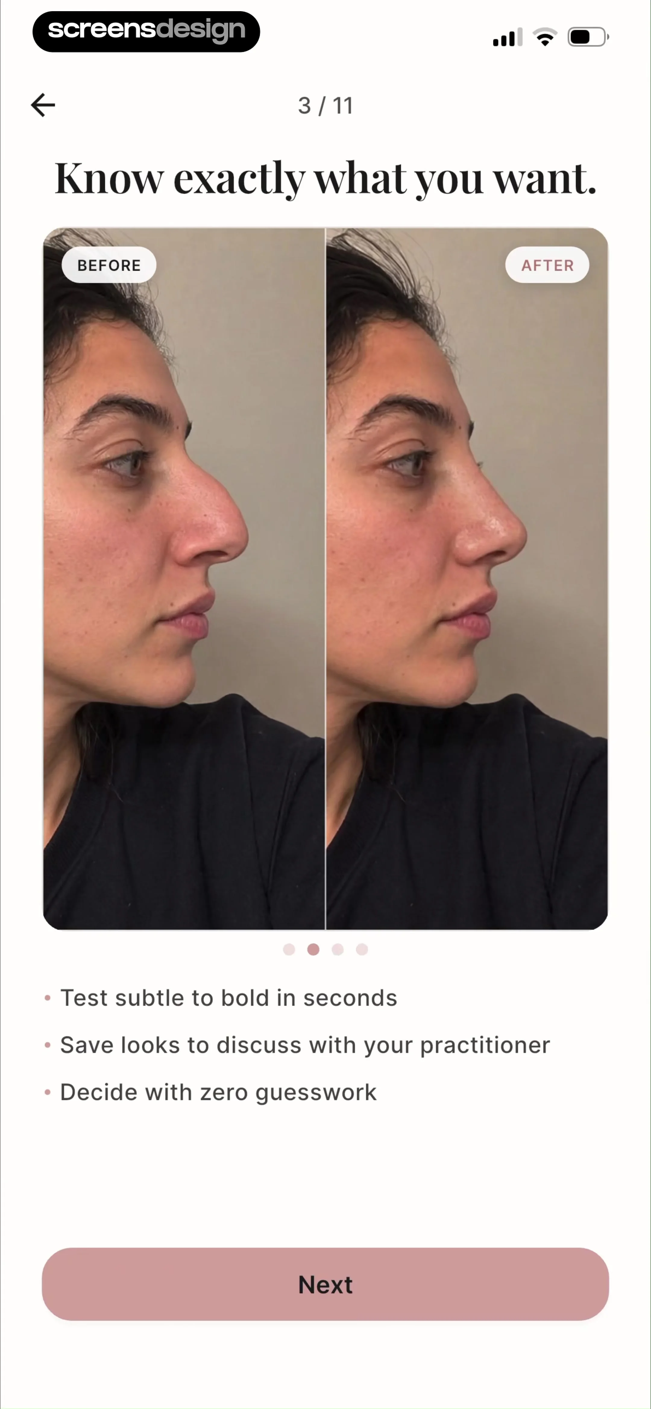 Refina: AI Plastic Surgery screen 6