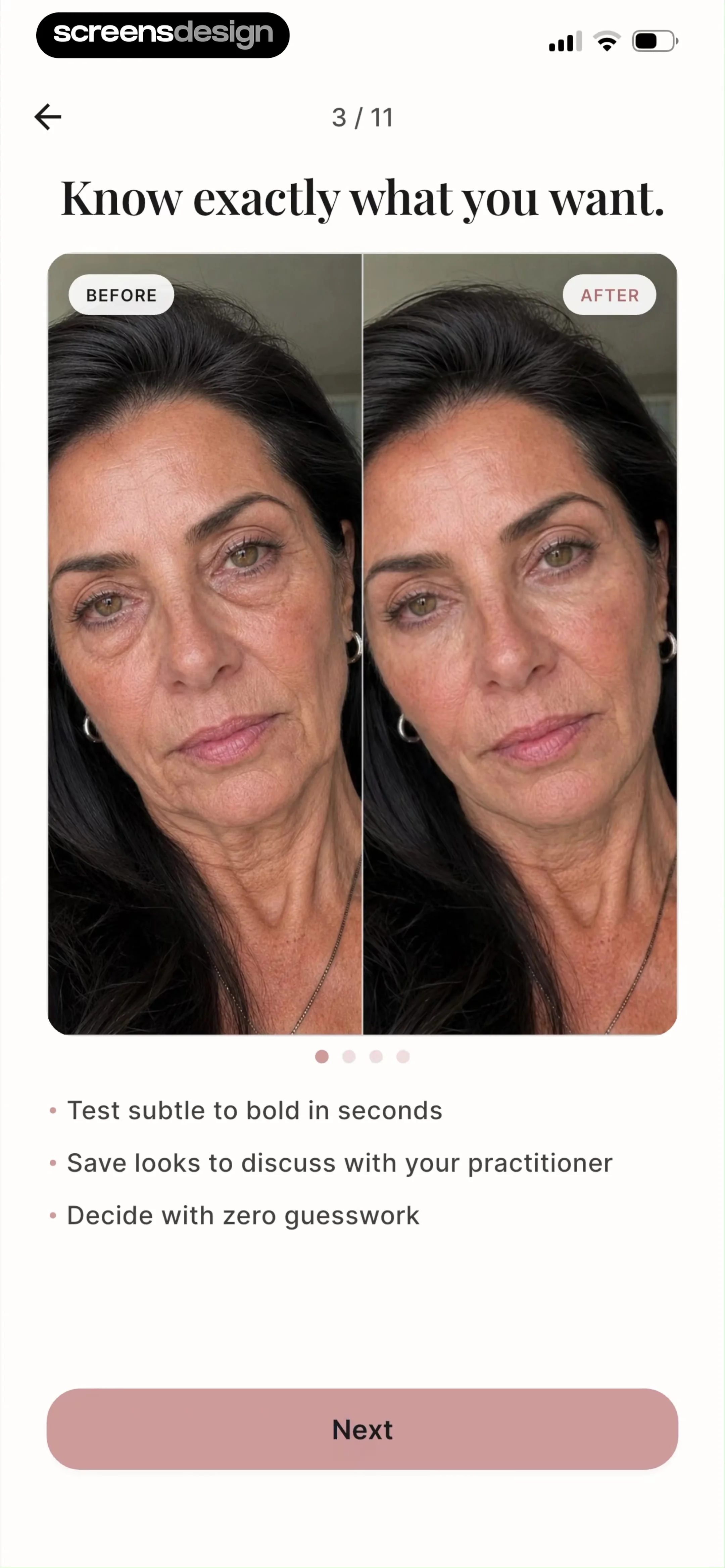 Refina: AI Plastic Surgery screen 5