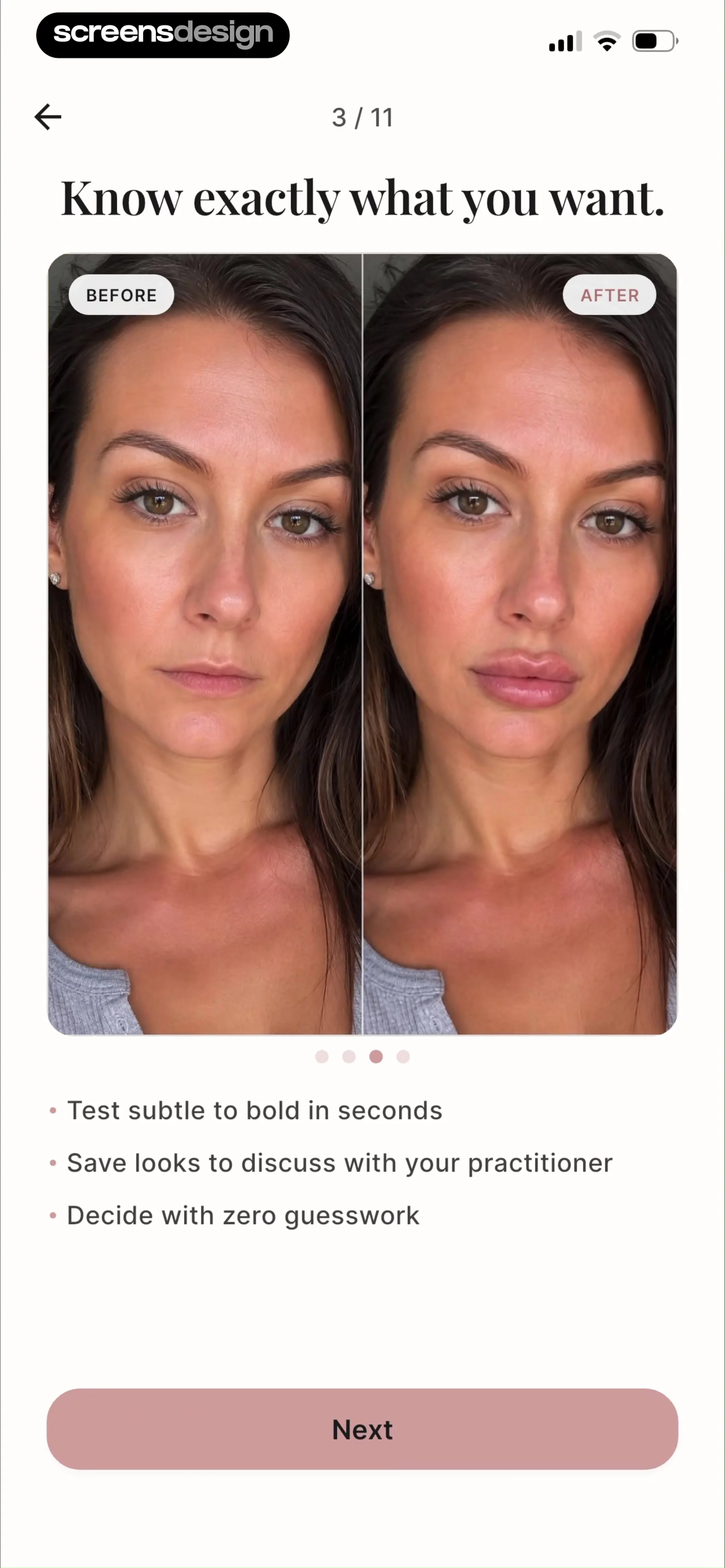 Refina: AI Plastic Surgery screen 7