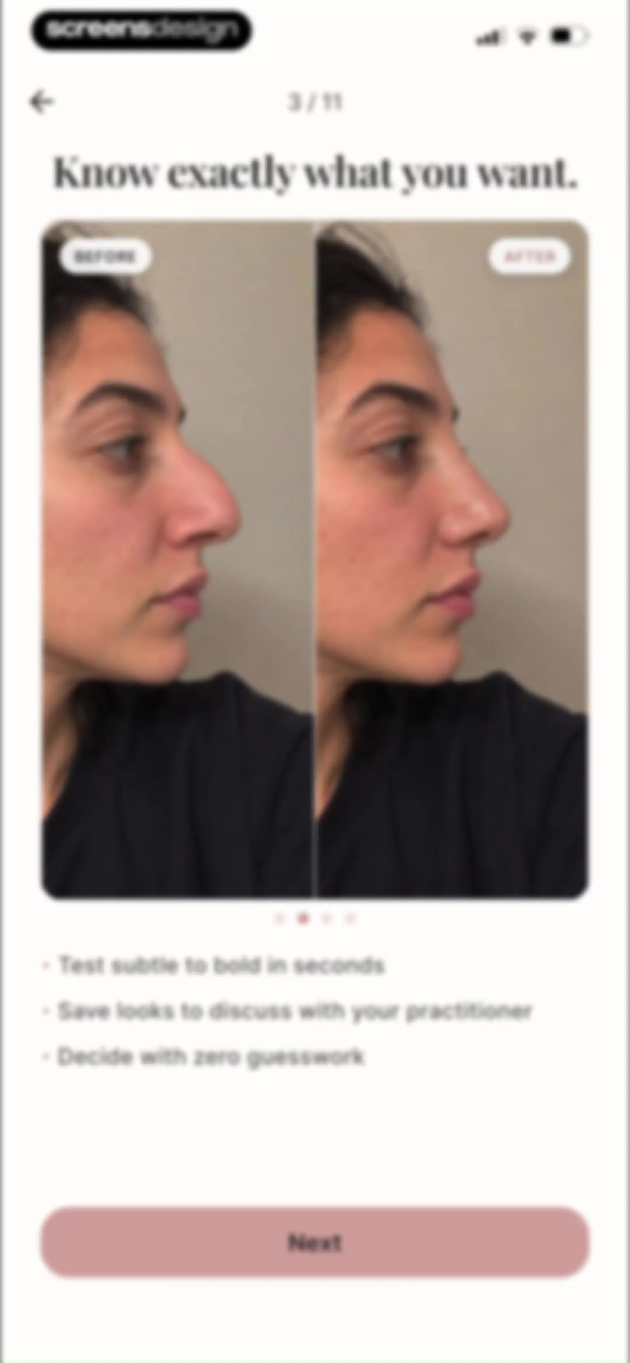 Refina: AI Plastic Surgery screen 6