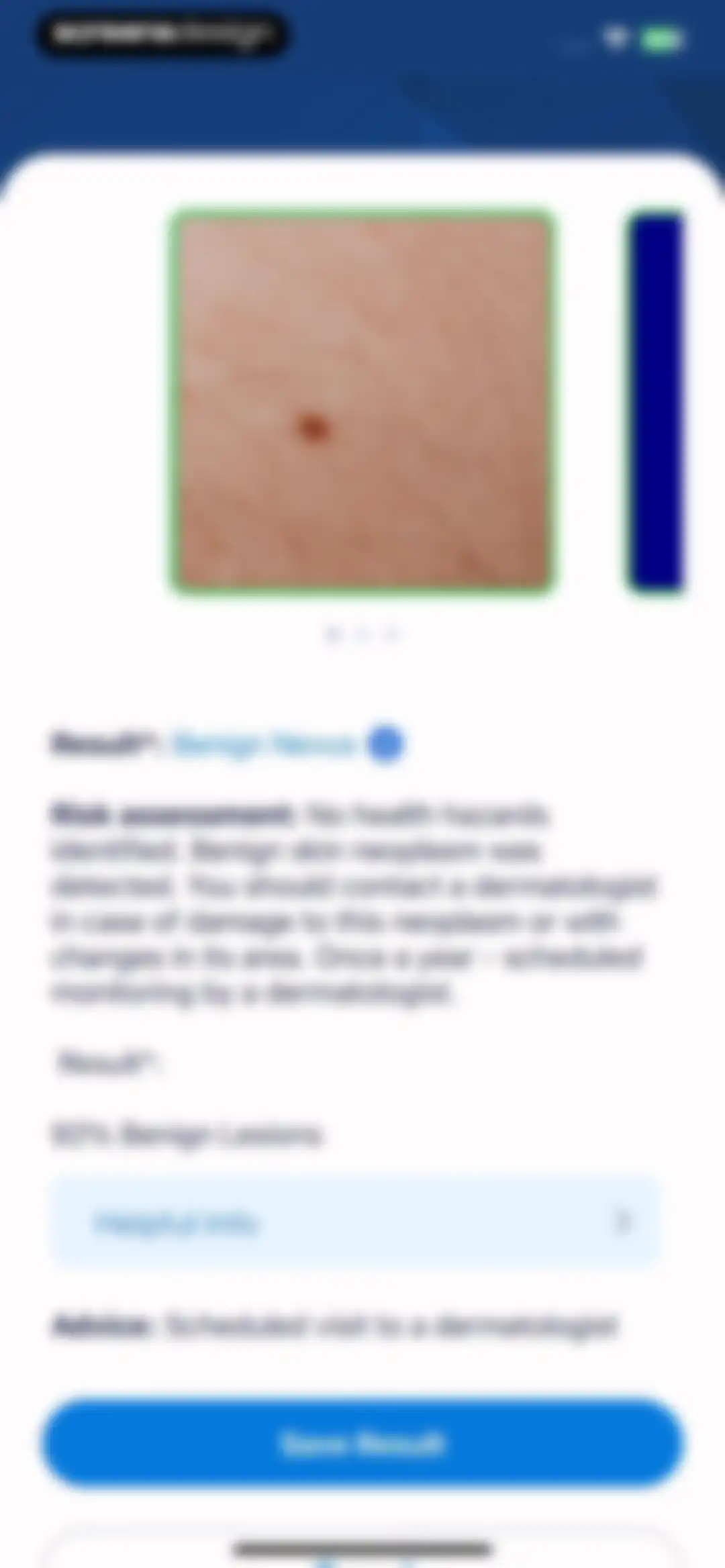 AI Dermatologist: Skin Scanner screen 13