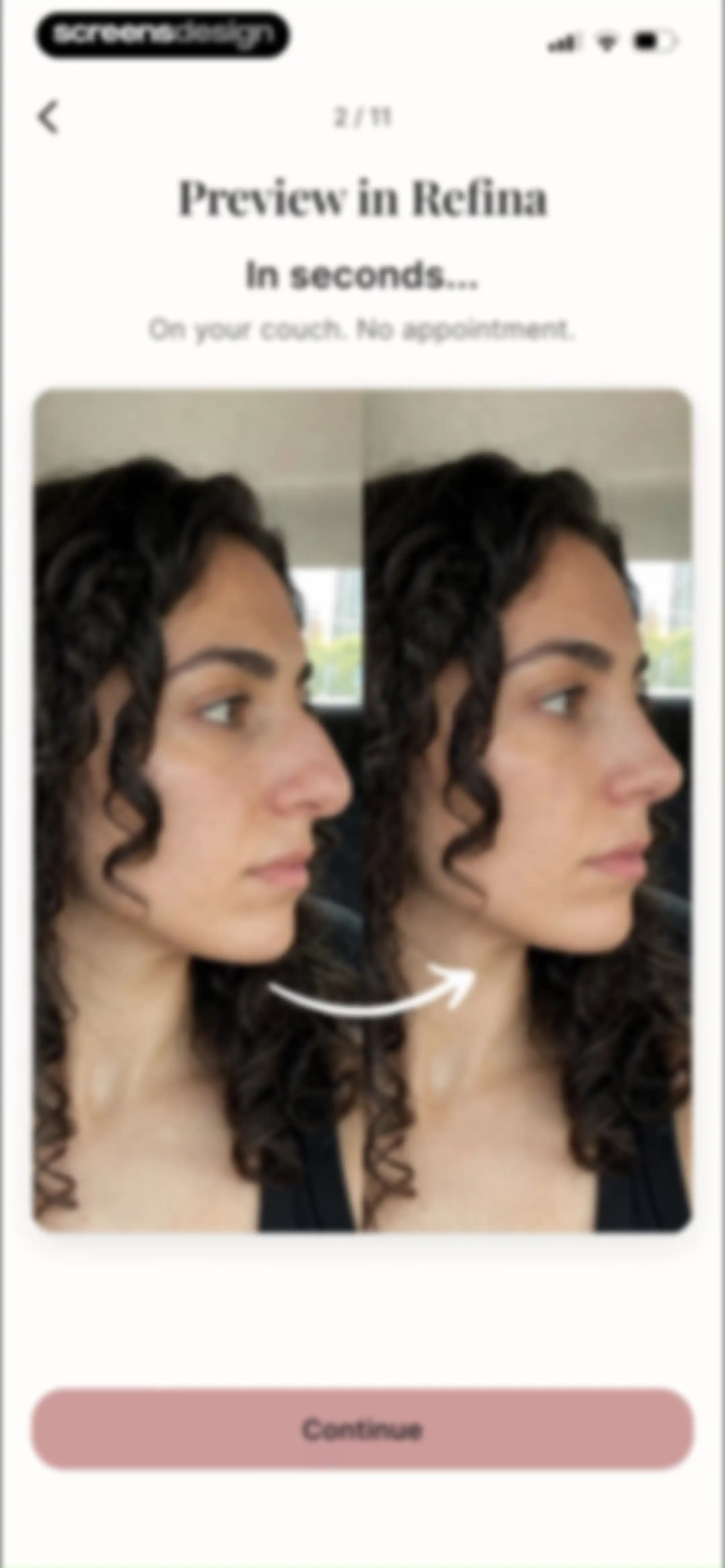 Refina: AI Plastic Surgery screen 4