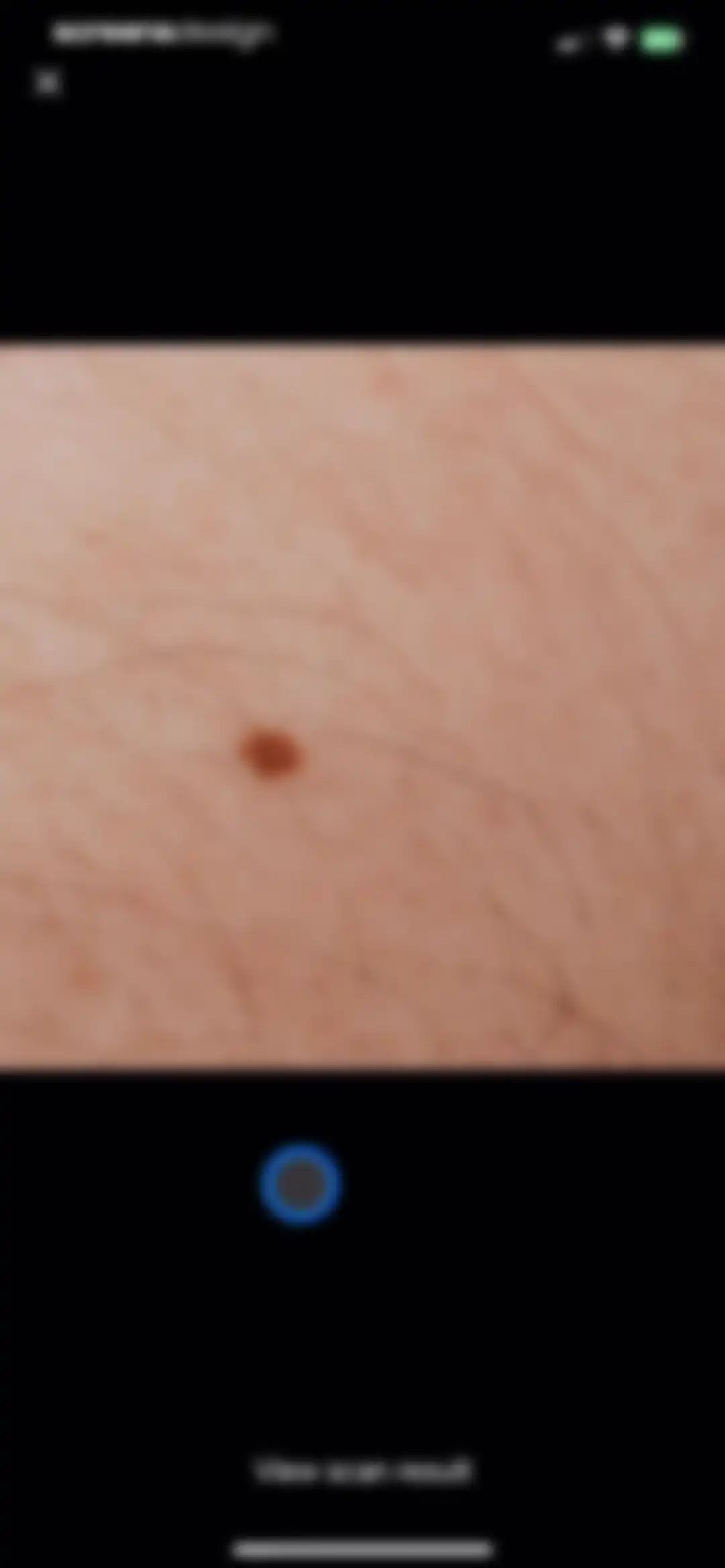 AI Dermatologist: Skin Scanner screen 23