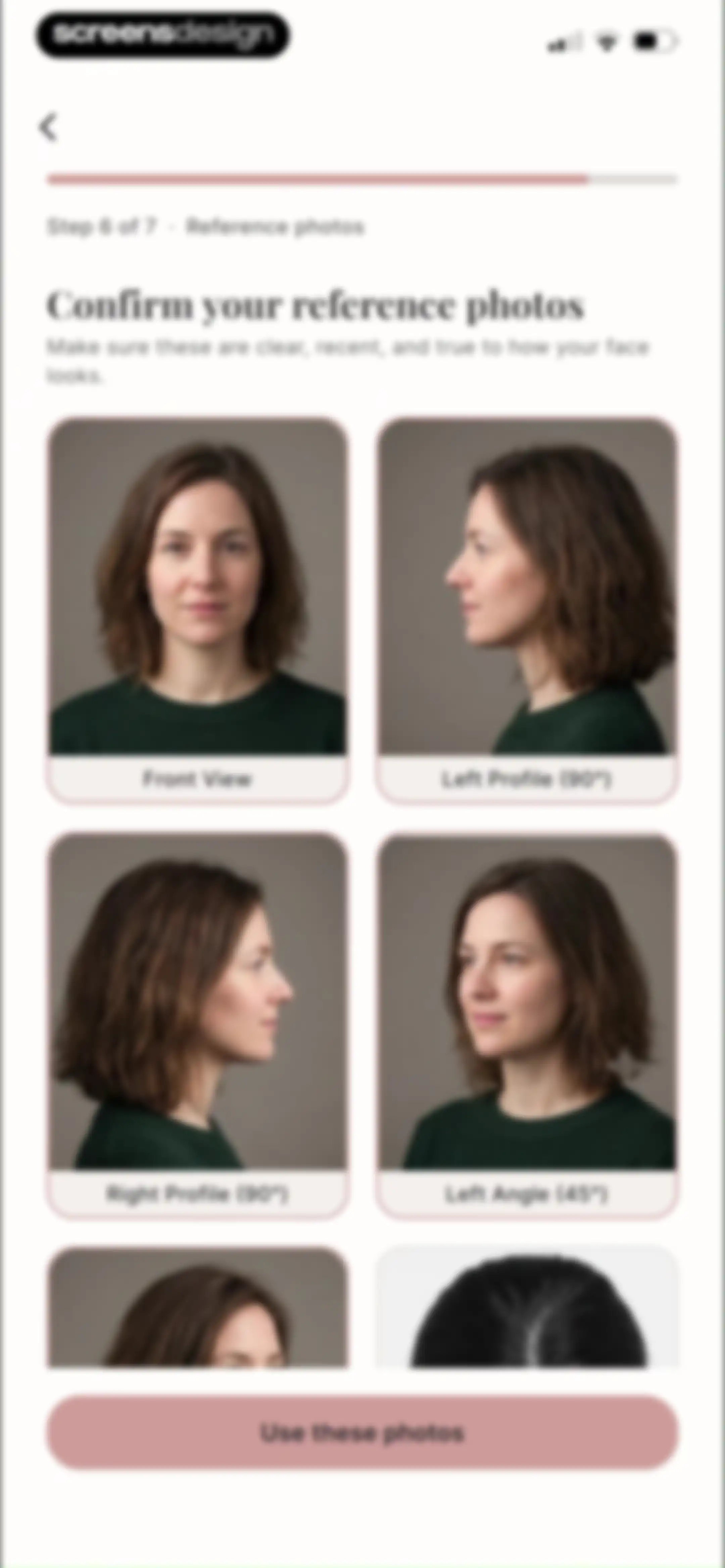 Refina: AI Plastic Surgery screen 37