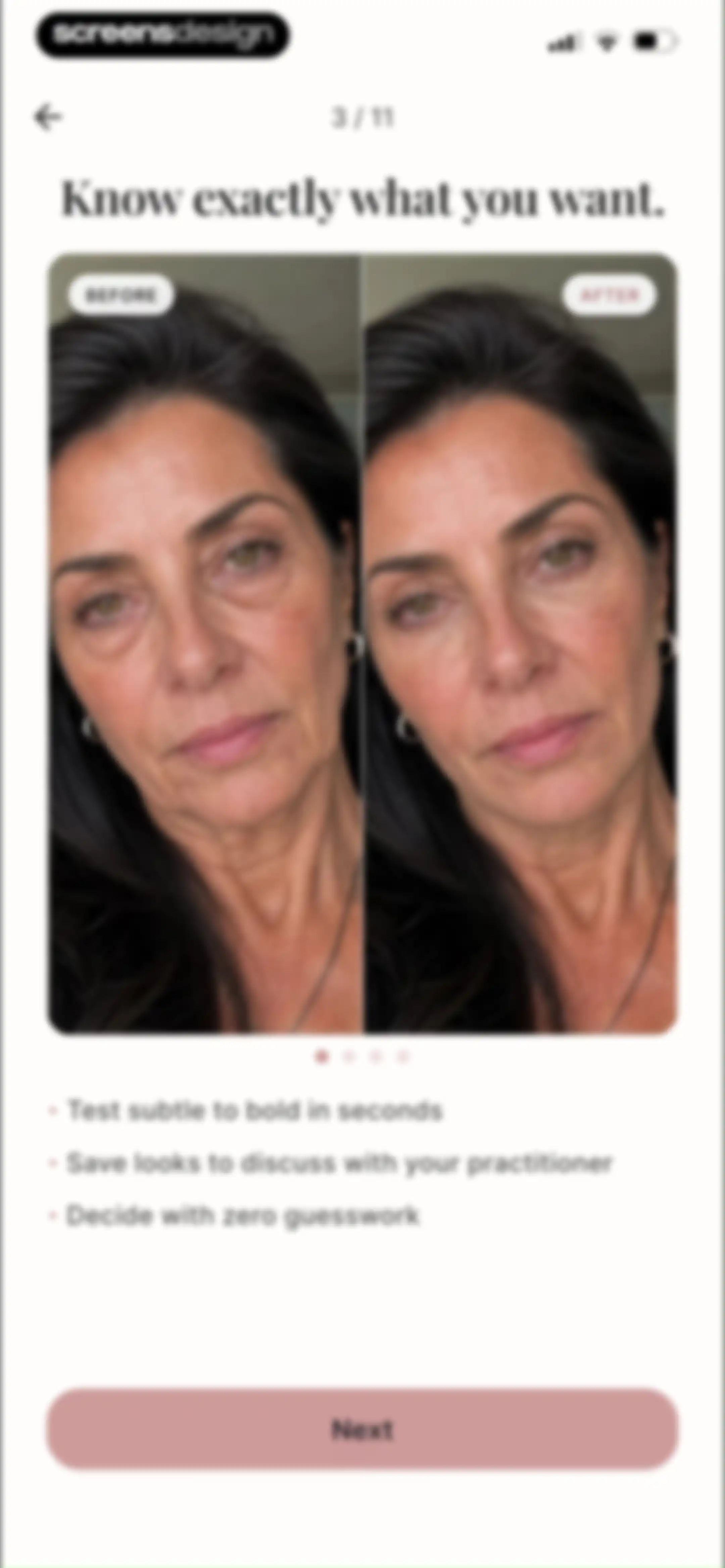 Refina: AI Plastic Surgery screen 5
