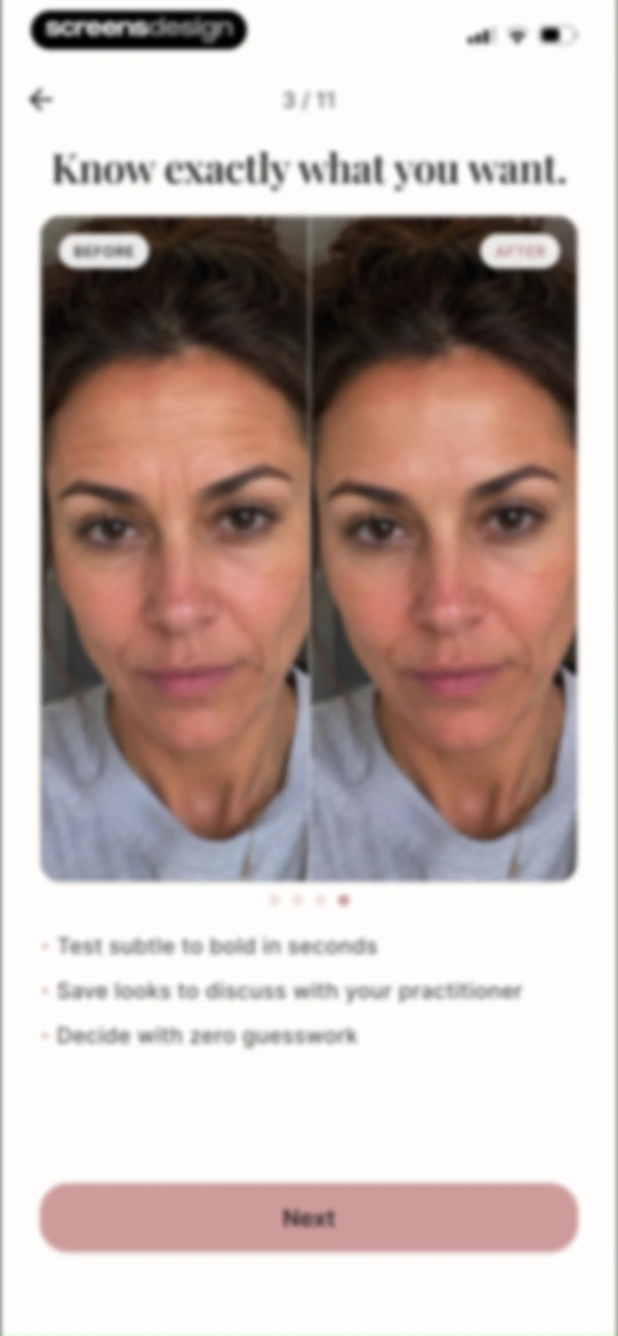 Refina: AI Plastic Surgery screen 8