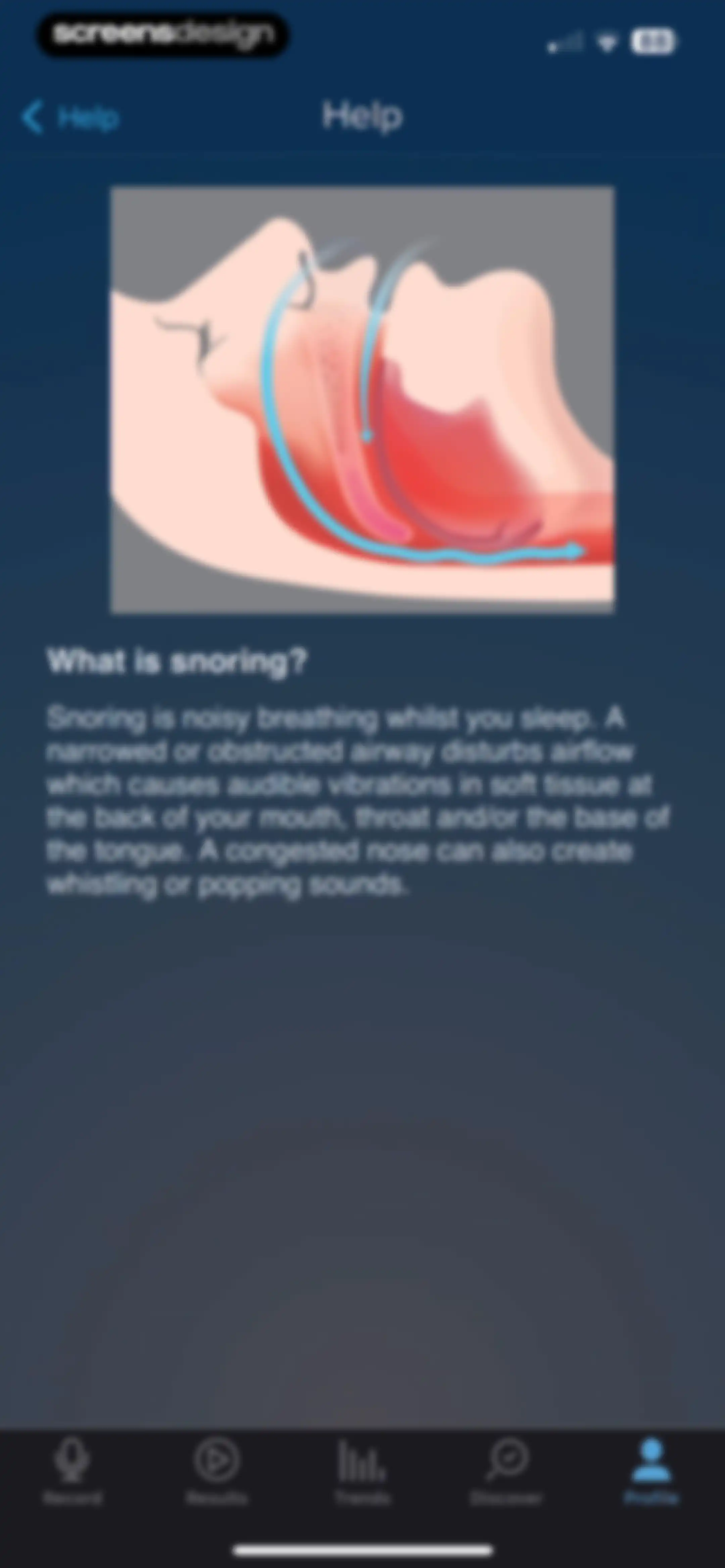 SnoreLab : Record Your Snoring screen 100