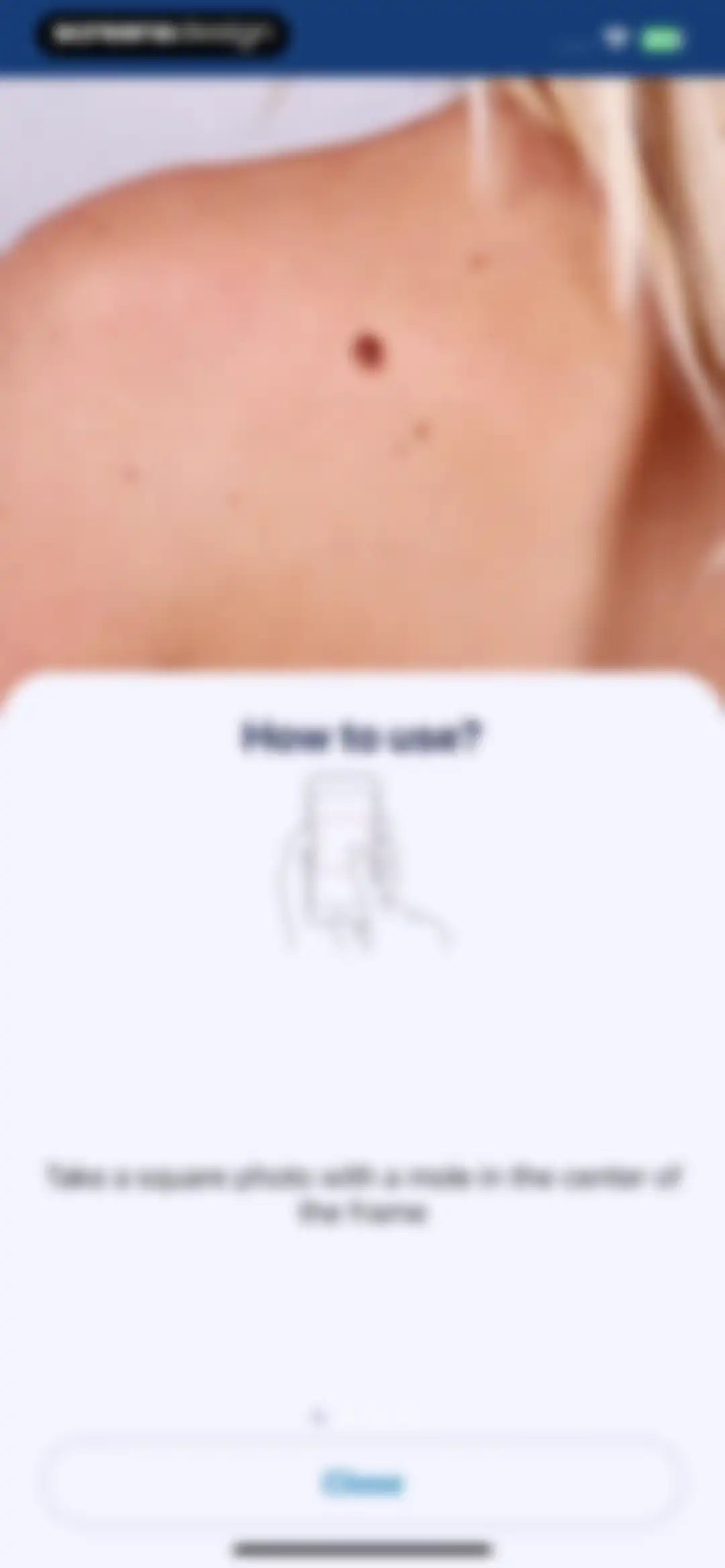 AI Dermatologist: Skin Scanner screen 32