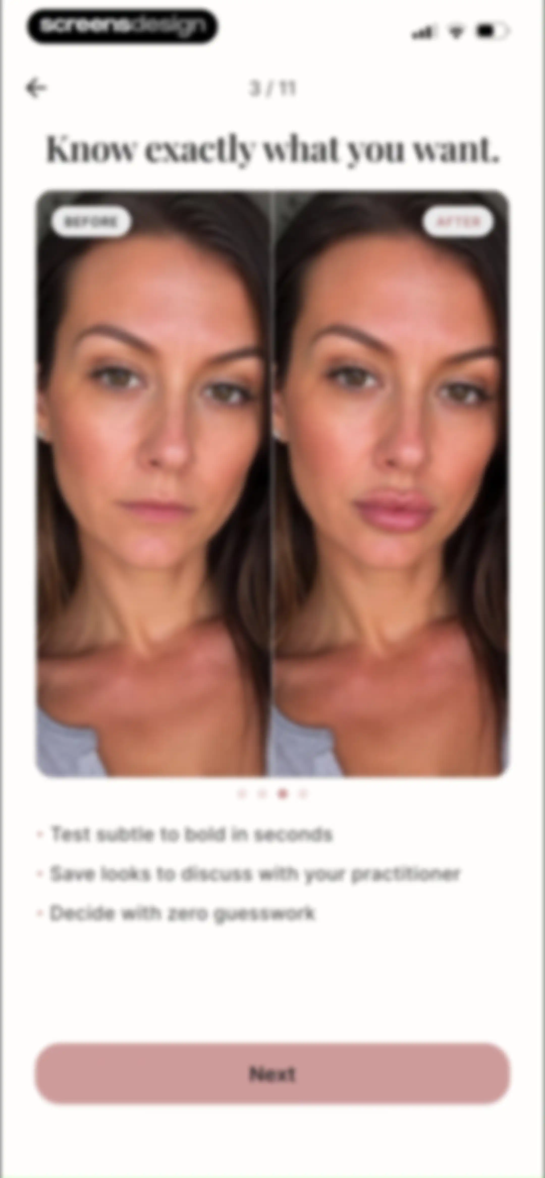 Refina: AI Plastic Surgery screen 7