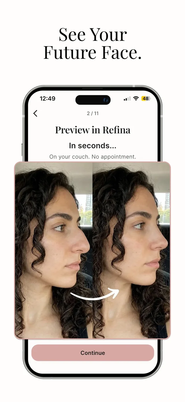 Refina: AI Plastic Surgery App Store screenshot 1