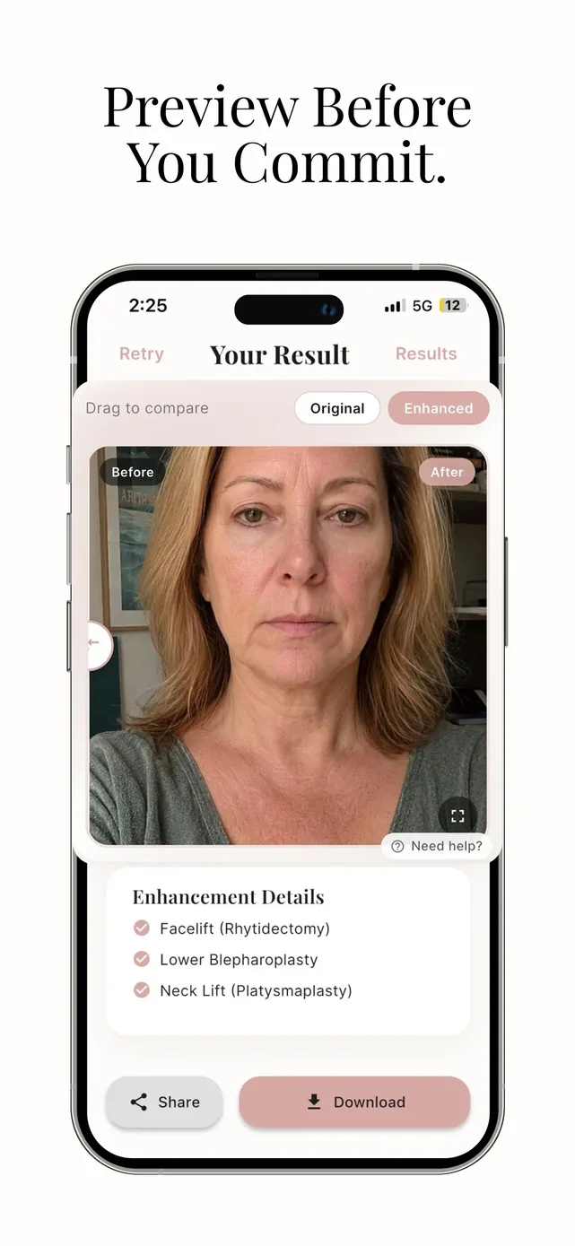 Refina: AI Plastic Surgery App Store screenshot 2